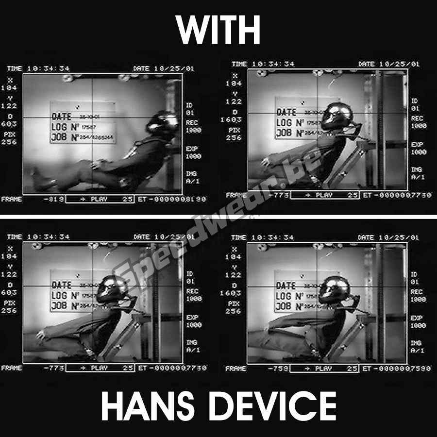 Hans Schroth 20° EVO Large nekbescherming autosport