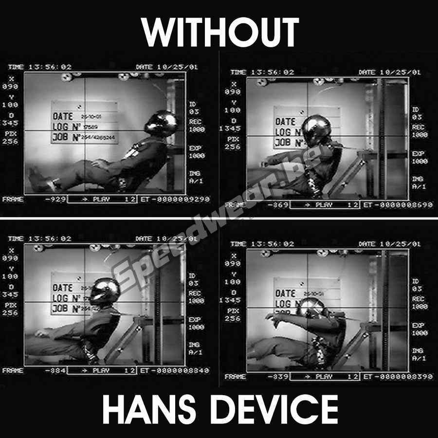 Hans Schroth 20° EVO Large nekbescherming autosport